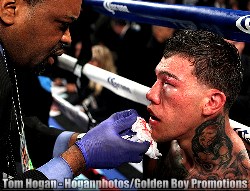 Gabriel Rosado (Right) is examined by the doctor after his tenth round technical loss to NABF Middleweight Champion David Lemieux