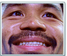 Manny Pacquiao - Photo © German Villasenor, Doghouse Boxing